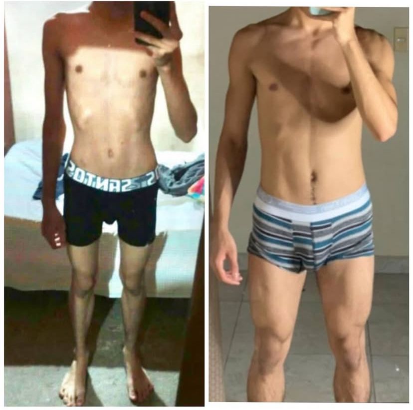 Resultado paciente 3